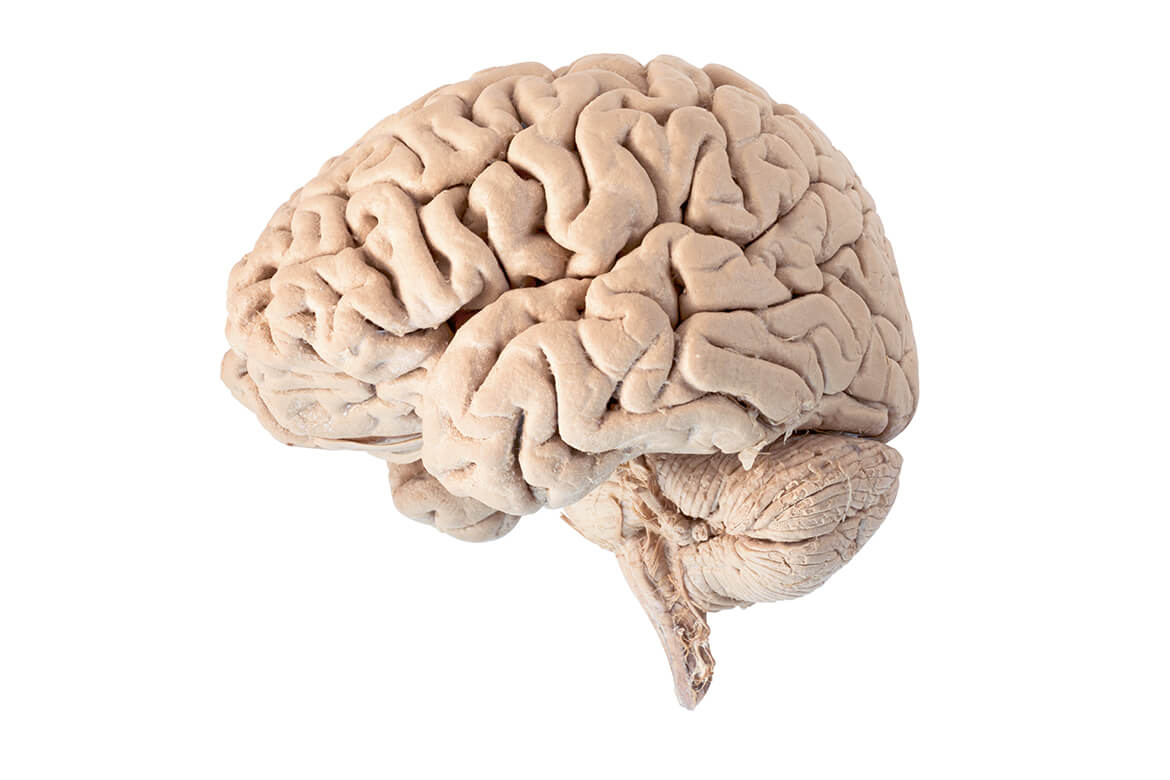 Les cerveaux ne sont pas tous pareils, mais certains se ressemblent davantage. | Image: shutterstock/Jesada Sabai