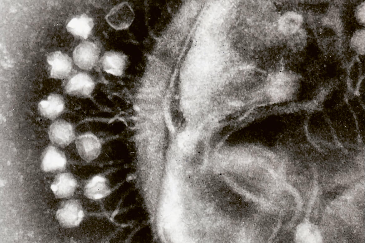 Hier docken Viren an die Zellwand eines Bakteriums an. Und können es ausschalten.